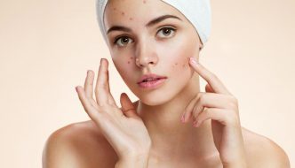 3 Obat Untuk Menghilangkan Jerawat dengan Alami