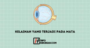 Kelainan Yang Terjadi Pada Mata