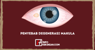 Penyebab Degenerasi Makula
