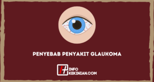 Penyebab Penyakit Glaukoma