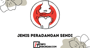 Jenis Peradangan Sendi