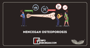Cara Untuk Mencegah Osteoporosis