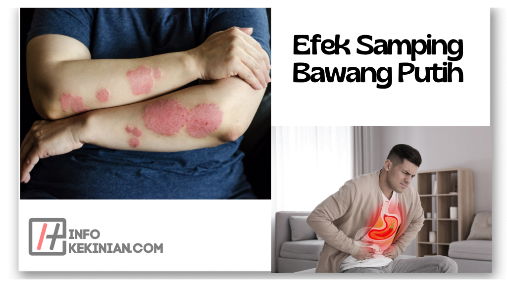 Efek Samping Bawang Putih