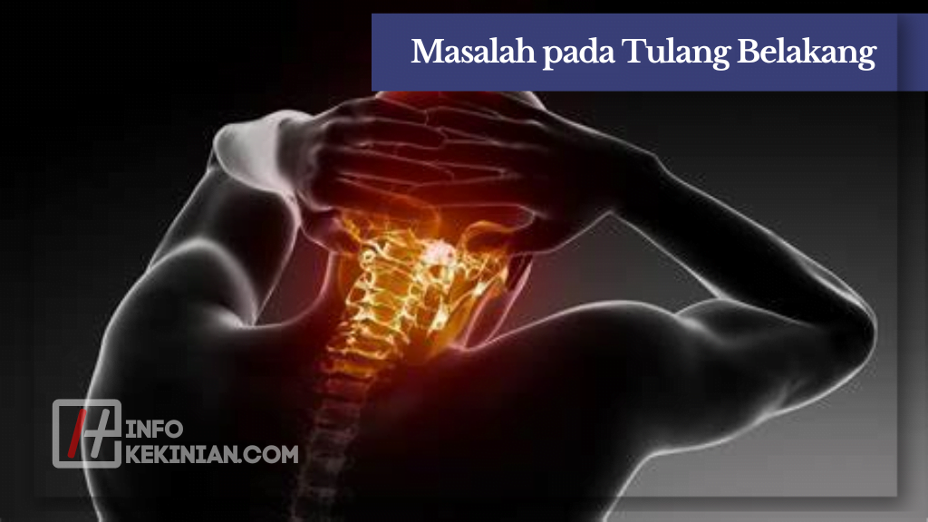 Masalah pada Tulang Belakang