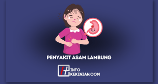 Gejala Penyakit Asam Lambung serta Penyebab, dan Pencegahannya, Wajib Diketahui!