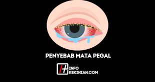 8 Faktor Penyebab Mata Pegal