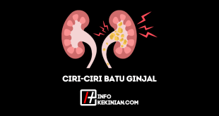 Ciri-Ciri Batu Ginjal yang Wajib Kamu Waspadai
