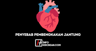 Penyebab Pembengkakan Jantung, Penting untuk Diwaspadai!