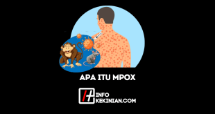Apa Itu Mpox_ Sejarah, Gejala, serta Aspek Penting Lainnya